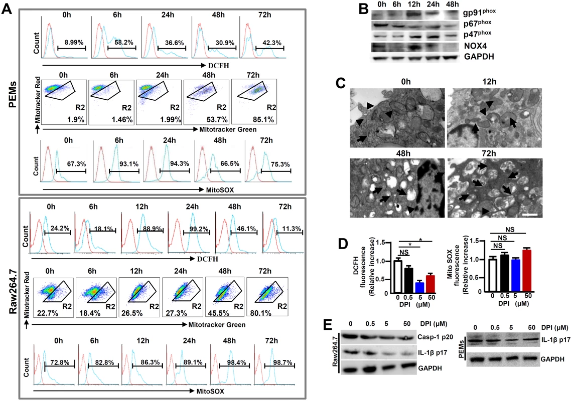 Enhanced ROS in macrophages following MHV-3 infection.