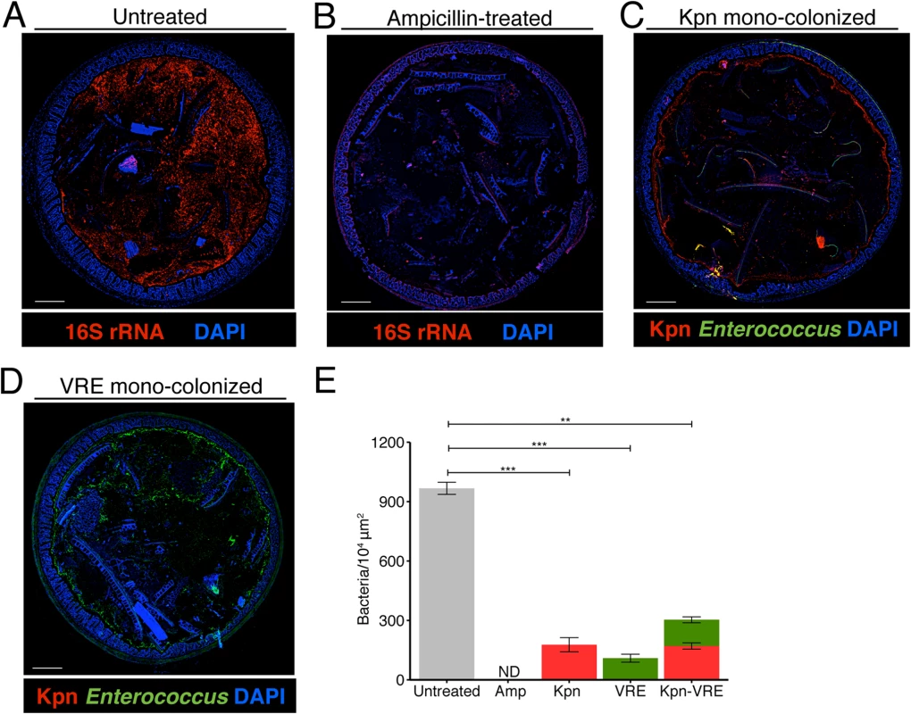 <i>K</i>. <i>pneumoniae</i> and VRE occupy a fraction of the total available space in the colon.