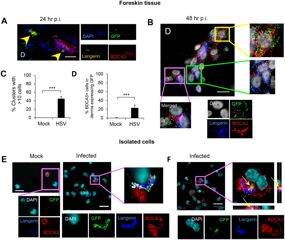Migration of HSV infected LCs into the dermis and their subsequent interaction with BDCA3<sup>+</sup> dermal DCs in clusters.