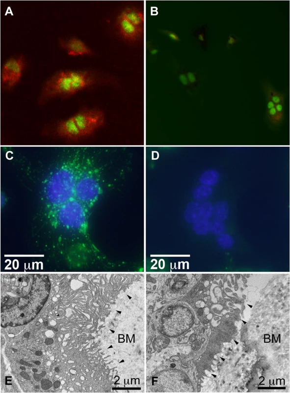 Snx10-deficient osteoclasts are unable to acidify have impaired endosomal pathways, and have defective ruffled borders.