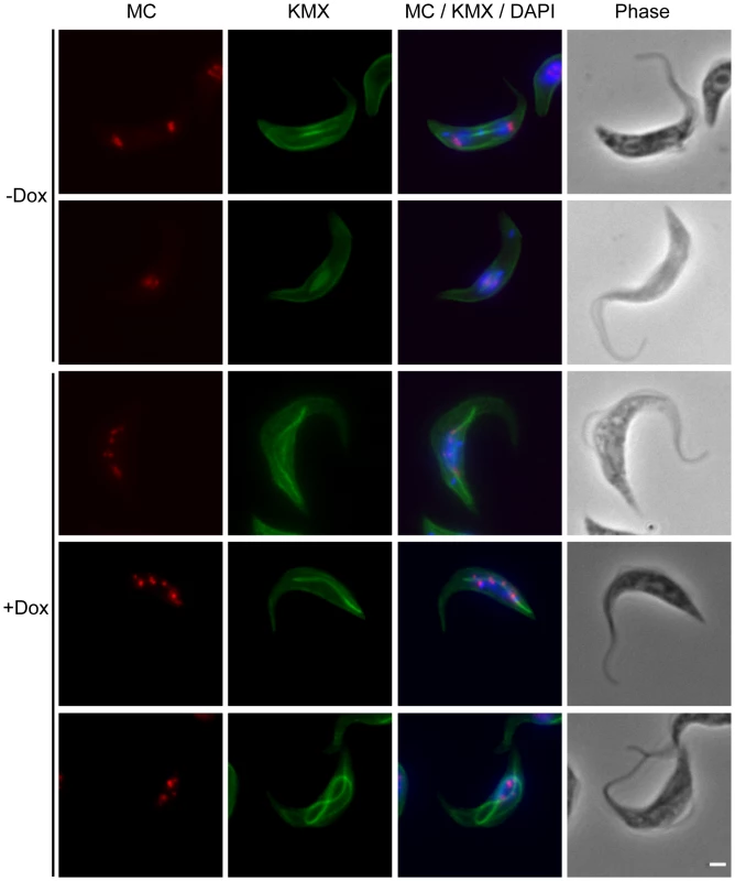 TbKif13-1 depletion results in chromosome segregation defects.