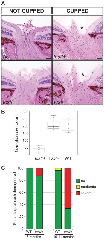 <i>Icst</i> causes defects of the optic nerve and the ganglion cell layer of the retina.