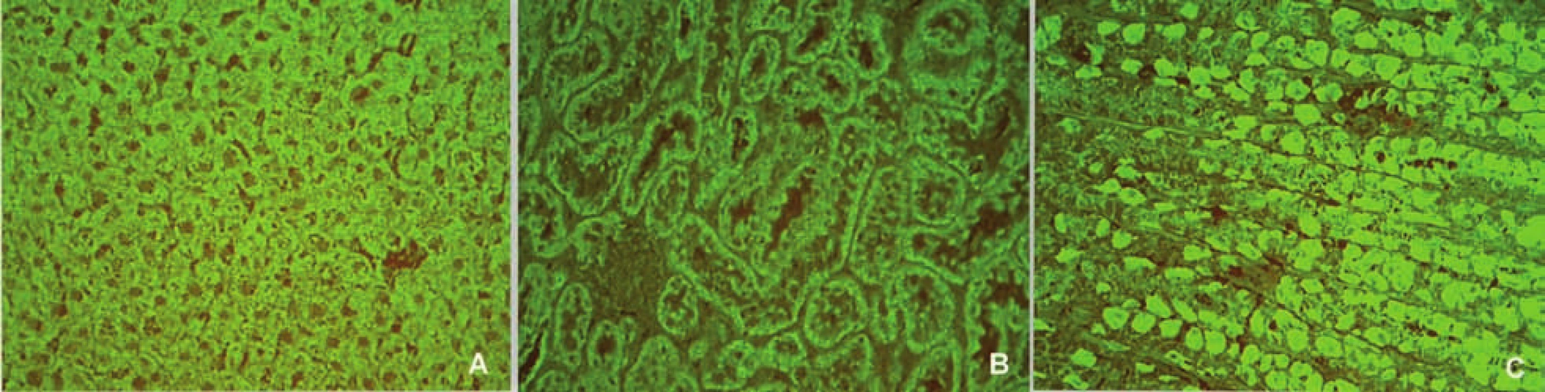 Imunofluorescenční obraz antimitochondriálních protilátek (substrát – krysí játra, ledvina a žaludek, A – jaterní buňky, B – proximální a distální tubuly, C – parietální buňky žaludeční sliznice).
Fig. 6. Immunofluorescent image of anti-mitochondrial antibodies (substrate – rat liver, kidney and stomach, A – liver cells, B – proximal and distal tubules, C – parietal cells of stomach mucosa).