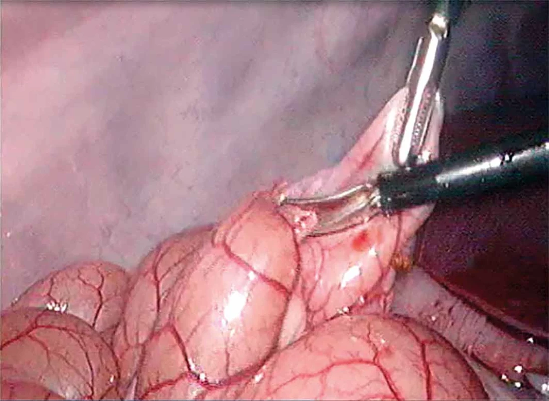 Model poranění trávicí trubice   Fig. 1: Digestive tract injury model