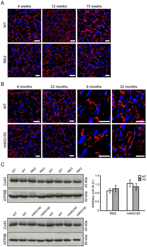 Altered connexin-43 localisation but not expression in the hearts of HD mouse models.