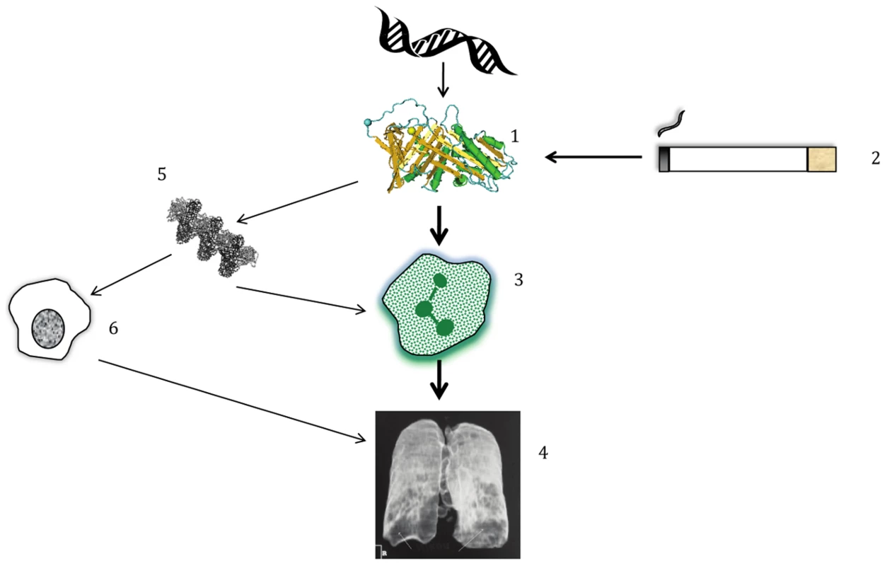 Simplified pathogenesis of lung disease in AATD.