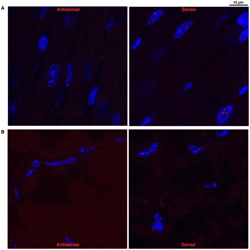 Foci accumulation was detected for both sense and antisense <i>DMPK</i> transcripts.