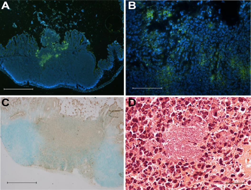 Persistent <i>Y. pseudotuberculosis</i> resides in cecal tissue in the presence of an immune response.