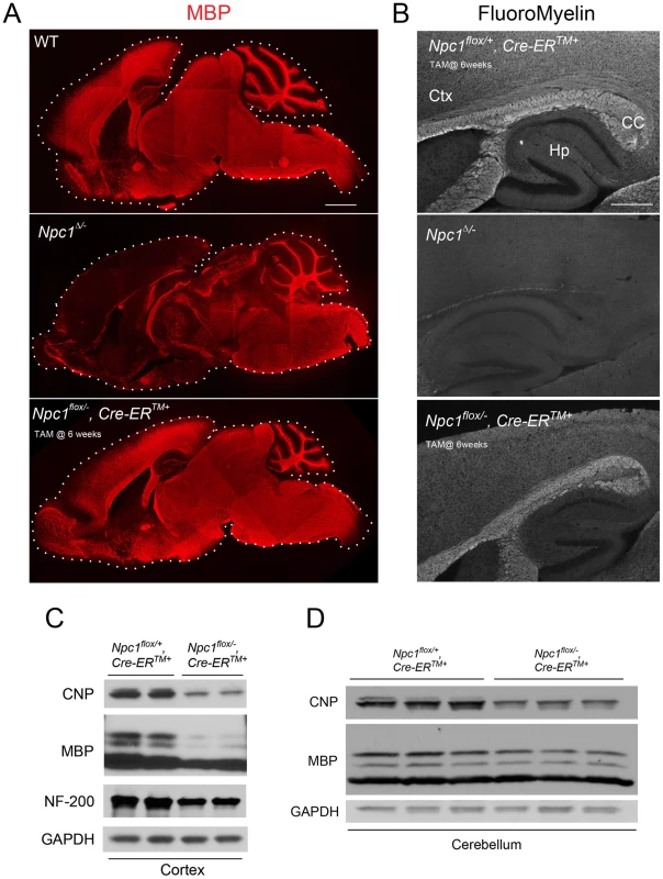 The effect of timing of <i>Npc1</i> deletion on CNS myelination.