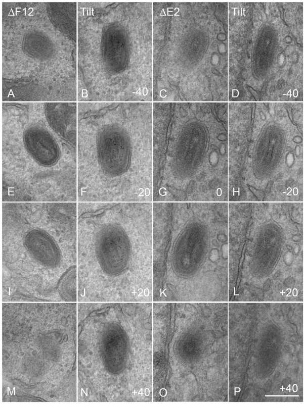 Serial section and tilt series electron microscopy showing vΔF12L and vΔE2L IEV are fully wrapped.