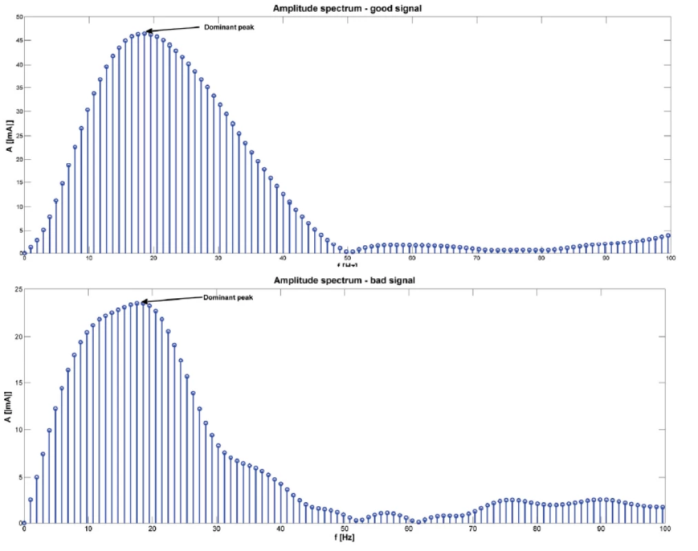 An example of amplitude spectrum of one signal (above for good signal, below for bad signal). The arrows show the dominant peak. Amplitude spectrum was calculated using fast Fourier transform.