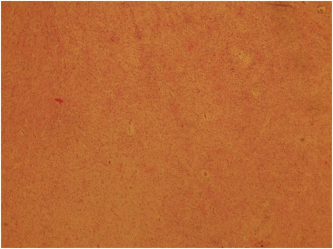 Histologický obraz
Fig. 7: Histological picture
