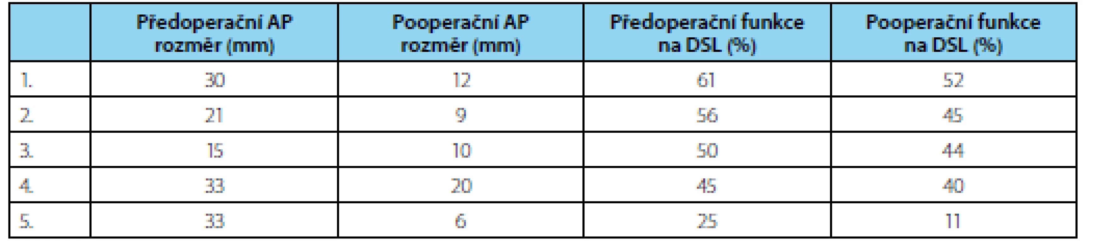 Pooperační pokles funkce ledviny po pyeloplastice u pěti pacientů
Tab. 1. Post-operative deterioration of differential renal function in five patients