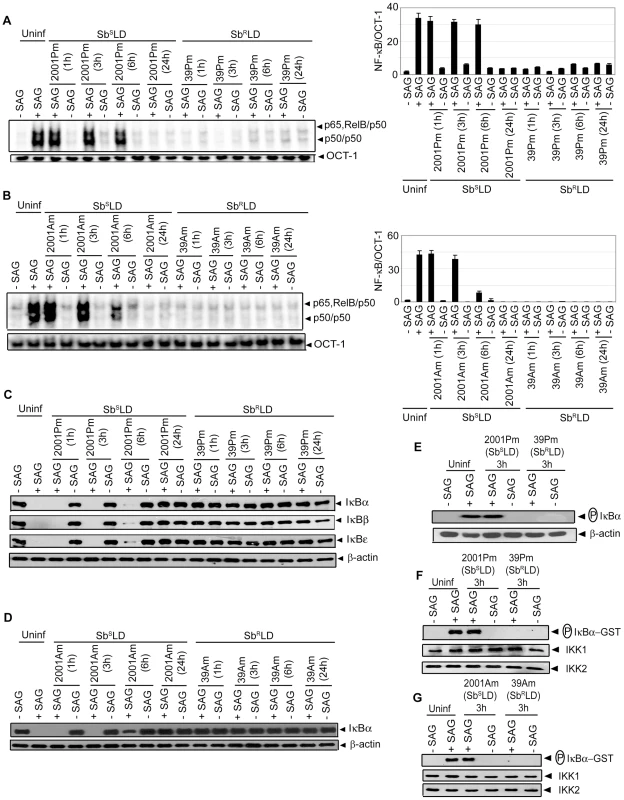 SAG-induced NF-κB signaling is inhibited in Sb<sup>R</sup>LD- and not Sb<sup>S</sup>LD-infected DCs.