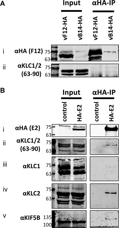 Endogenous KLC2 co-immunoprecipitates with E2.