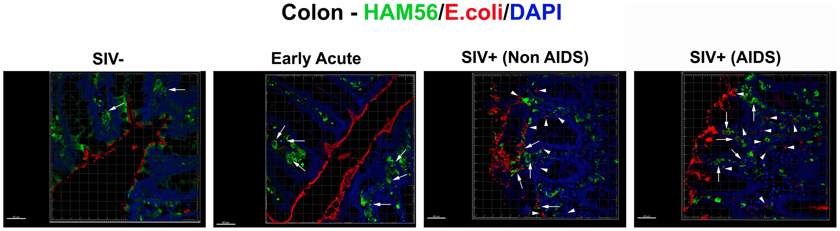Microbial products are differentially phagocytosed in acutely and chronically SIV-infected RMs.