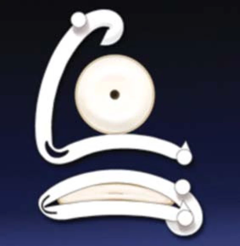 Vasclip Implant Device.