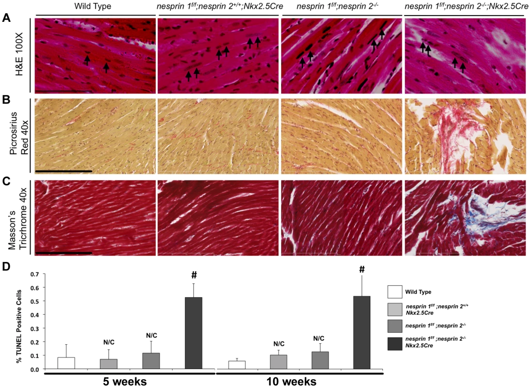 Histological and TUNEL analyses of Nesprin 1 and/or 2 ablation.