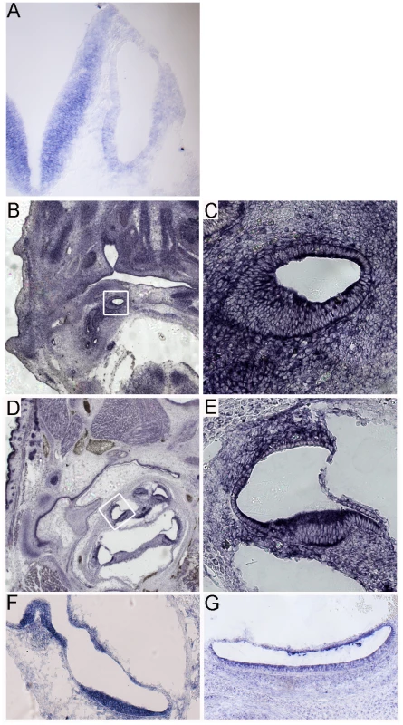 <i>Sfswap</i> is expressed in the developing inner ear.