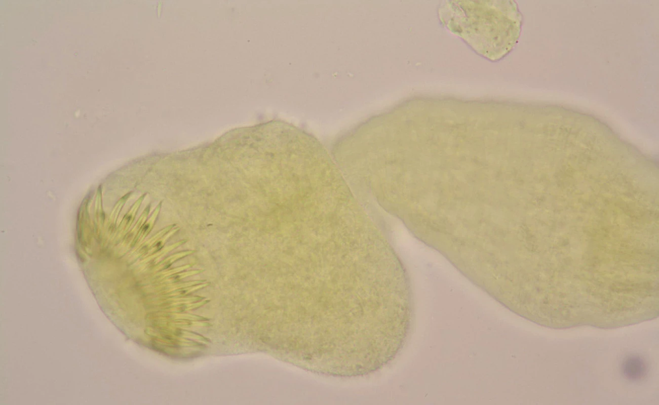 Parazitární skolex echinokoka s charakteristickými háčky získaný z obsahu tekutiny cysty (glycerinamonium pikrát, 1000x)
Fig. 4: Echinococcus’ scolex with characteristic hooks, obtained from the cyst fluid (glycerin-ammonium picrate, 1000x)