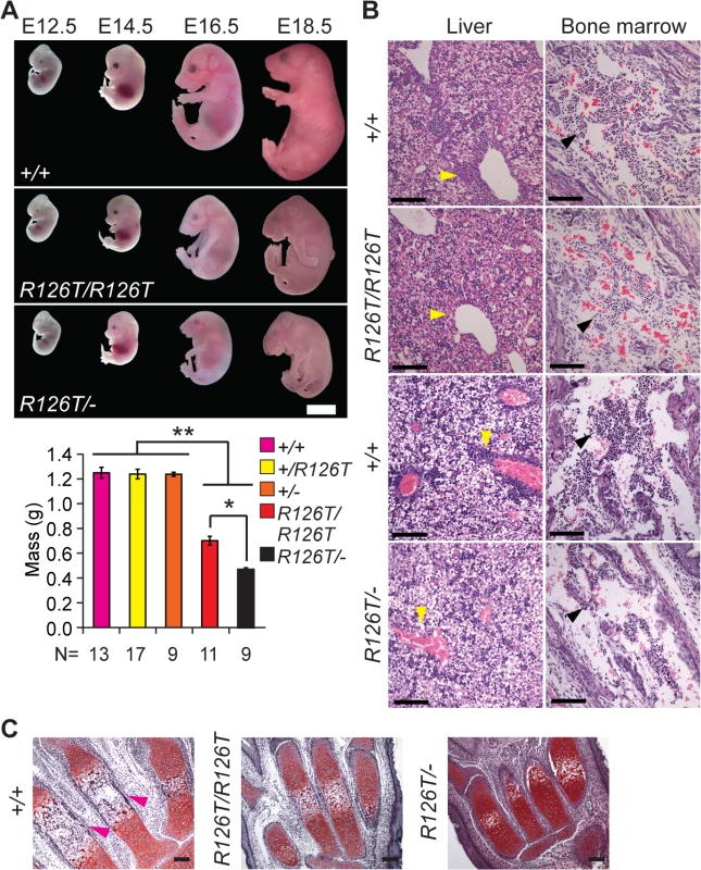 Sbds mutants display ribosomopathy and SDS phenotypes.