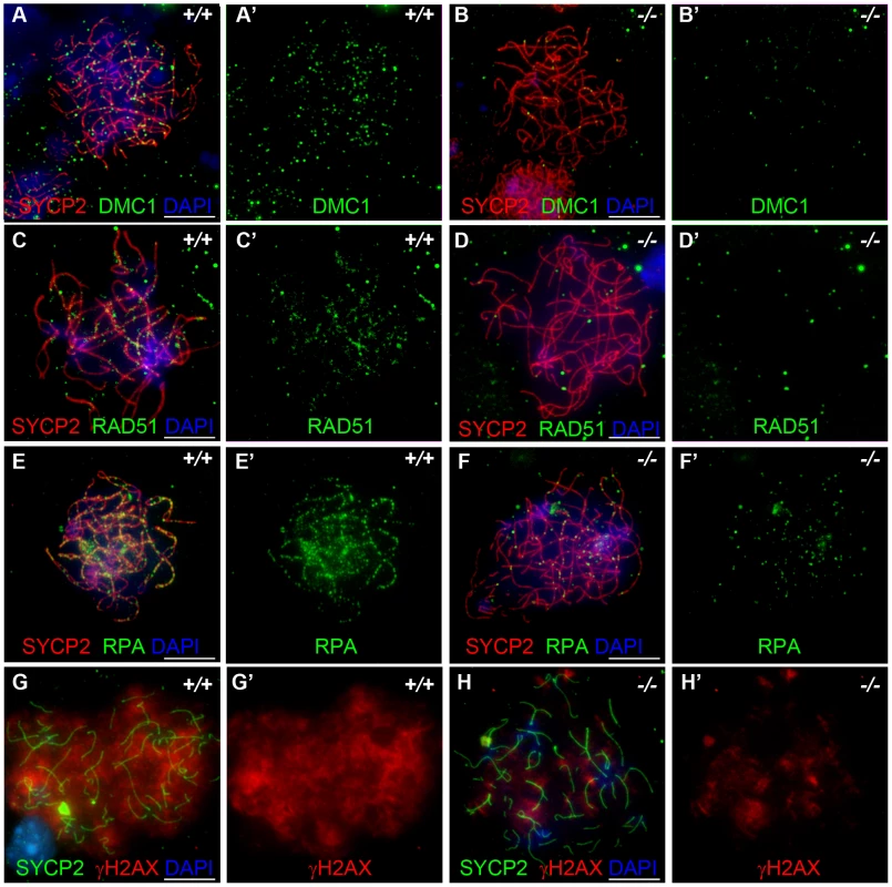 <i>Hormad <sup>−/−</sup></i> fetal oocytes are defective in early recombination.