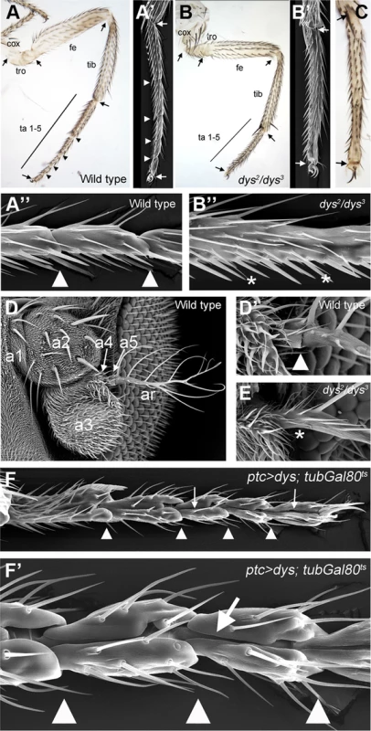 <i>dys</i> loss and gain of function phenotypes.