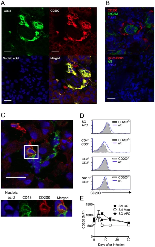 CD200 is expressed during <i>in vivo</i> MCMV infection.