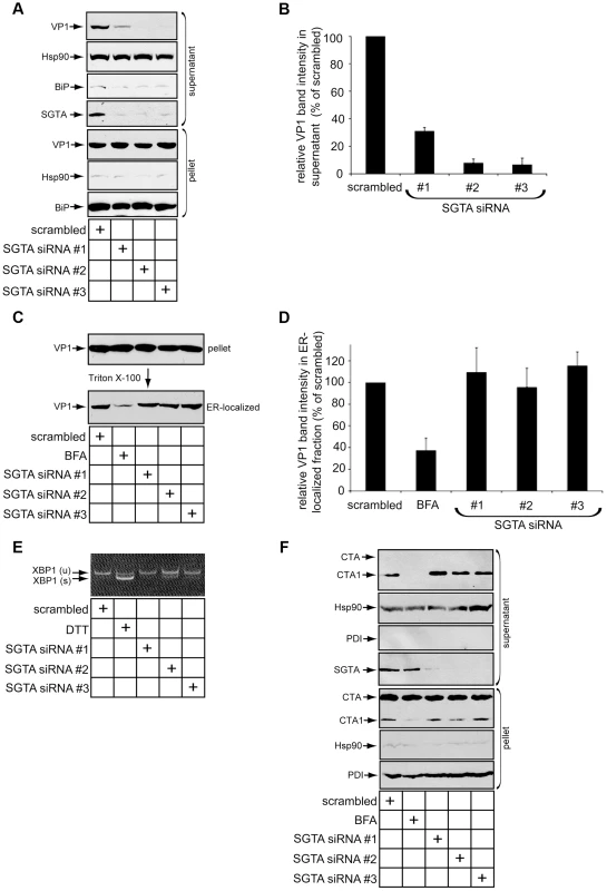 SGTA knockdown blocks viral ER-to-cytosol transport.