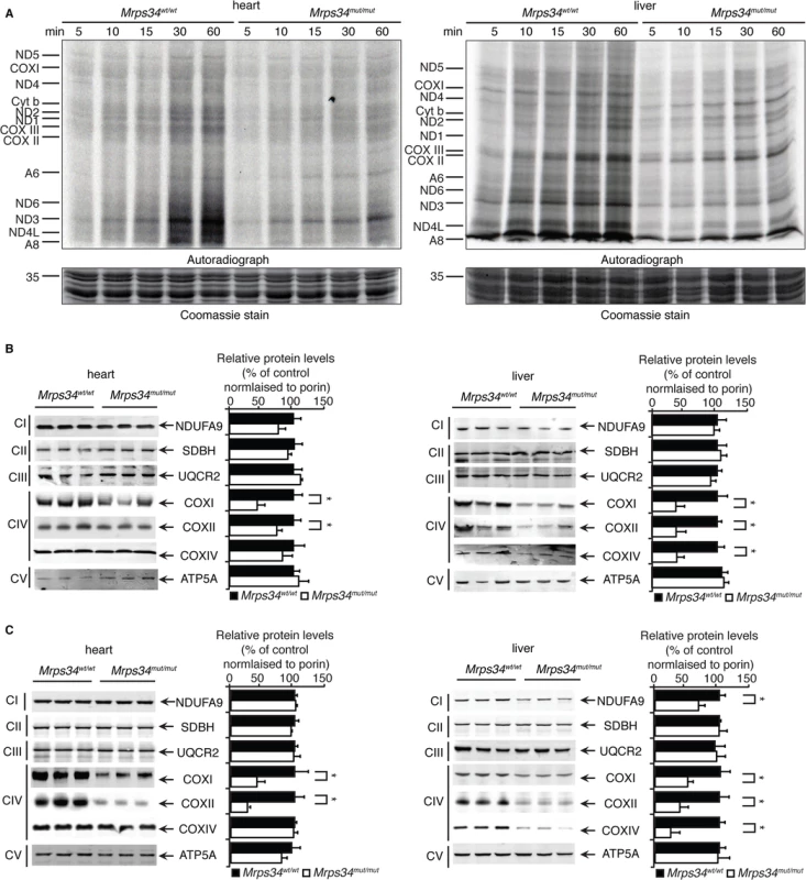 Decreased MRPS34 levels cause a reduction in mitochondrial protein synthesis and steady state levels of mitochondrial proteins.