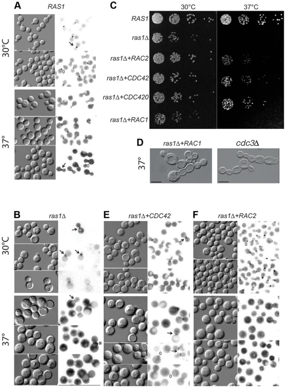 Septin localization in <i>C. neoformans</i> cells at 30 and 37°C after 4 hours.