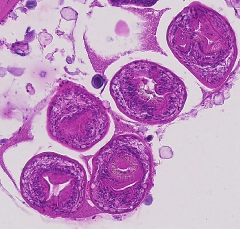 Skupina protoskolexů v různých úrovní a úhlu řezu z cysty v játrech. Barveno hematoxylinem eozinem (zvětšení 400x).