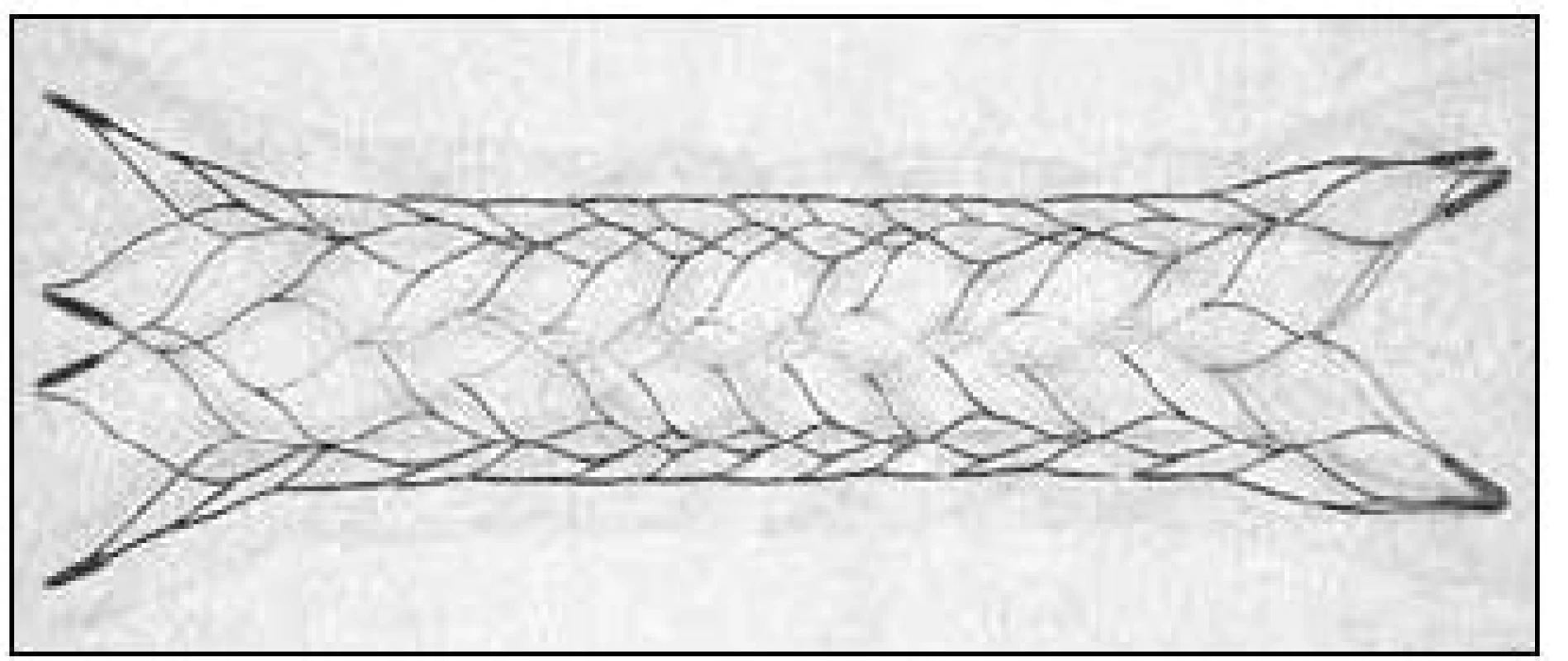 Enterprise<sup>TM</sup> stent (Cordis Neurovascular, Miami Lakes, FL, USA).
Available from: URL: http://www.depuy.com/healthcare-professionals/product-details/enterprise-vascularreconstruction-device-and-delivery-syst.