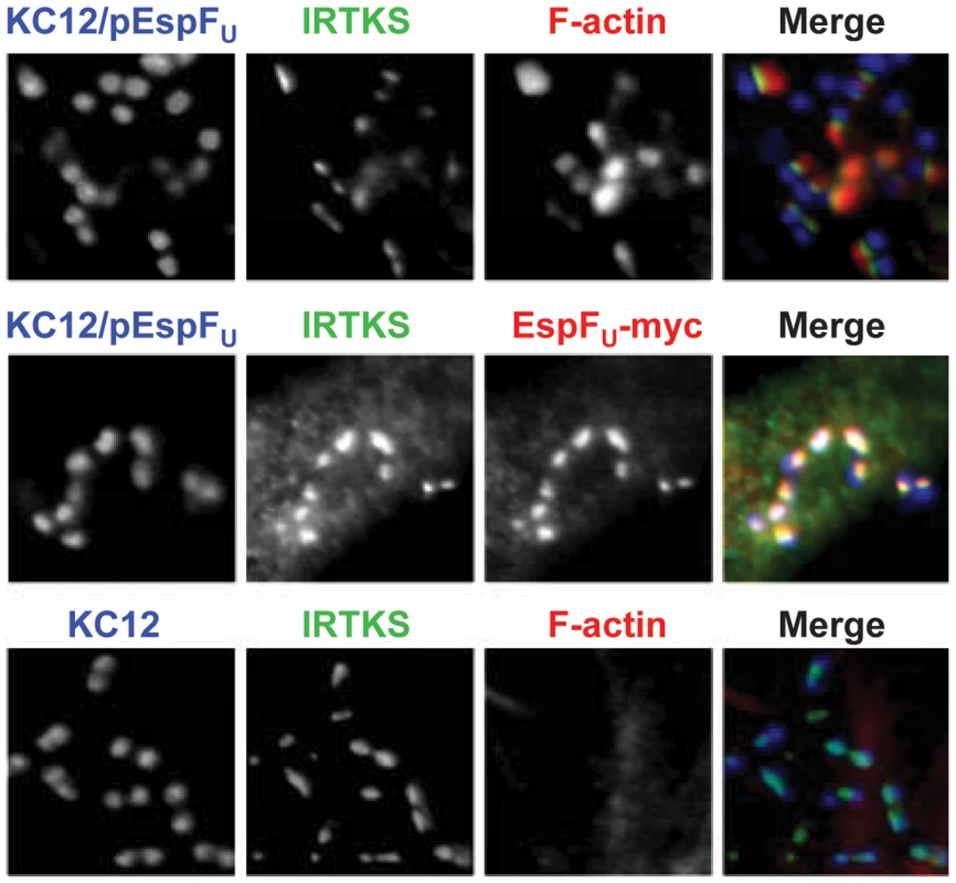 The Tir-EspF<sub>U</sub> linker protein IRTKS localizes to bacteria even in the absence of N-WASP.
