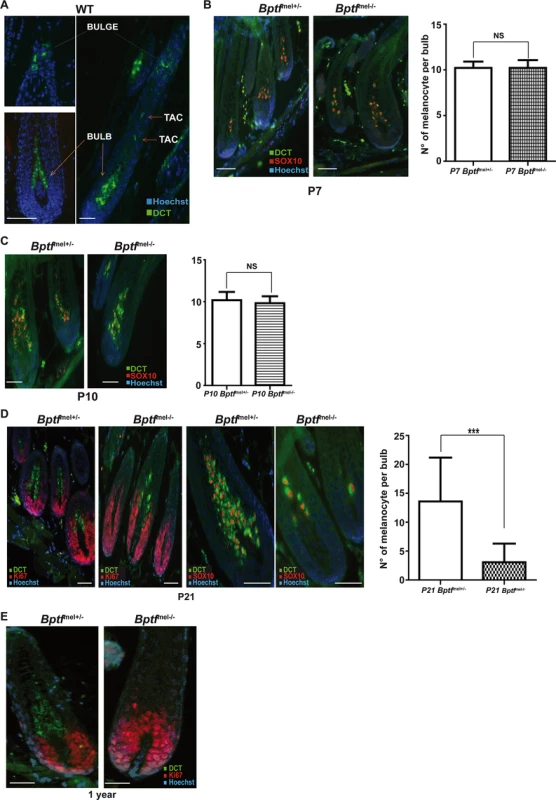 Loss of differentiated melanocytes in the bulb region of post-natal <i>Bptf</i><sup>mel-/-</sup> mice.