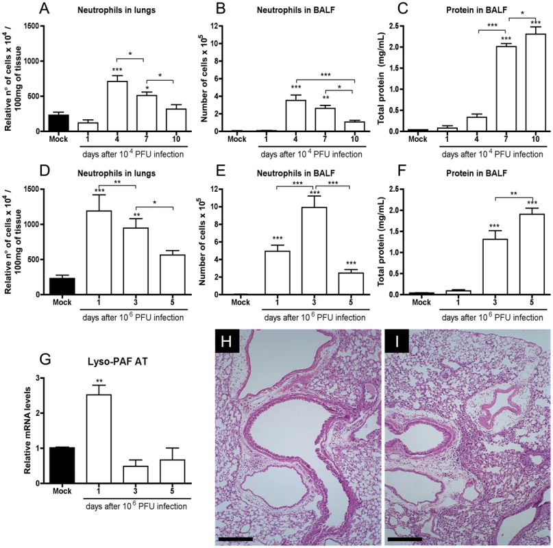 Inflammatory profile following Influenza A/WSN/33 H1N1 infection.