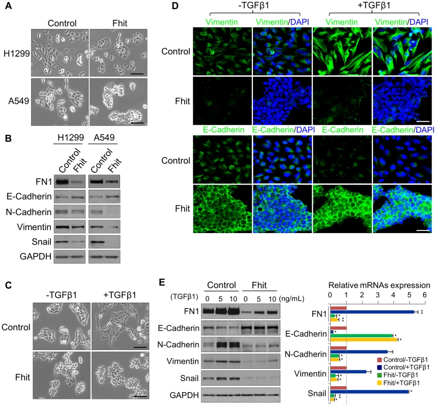 FHIT modulates EMT in NSCLCs through the suppression of EMT-related genes.