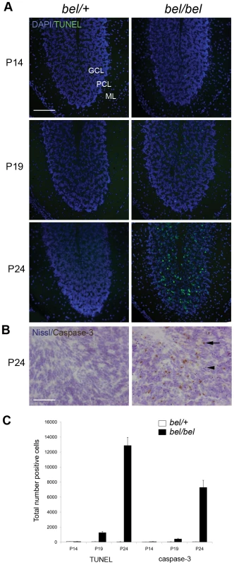 Progressive neurodegeneration in the <i>bel</i> mutant.