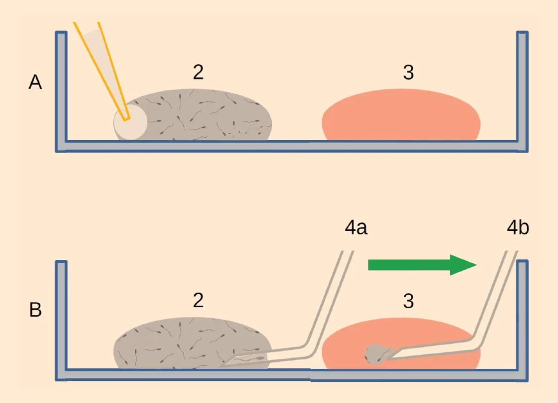 Obrázek znázorňuje postup aktivace pohybu spermií pomocí inhibitoru fosfodiesterázy.</br>Fig. 3. The fi gure shows procedure for activating sperm movement using a phosphodiesterase inhibitor.