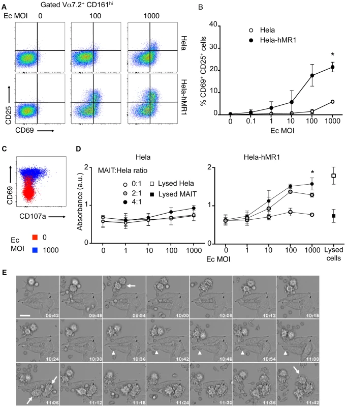 Human MAIT cells are cytotoxic.