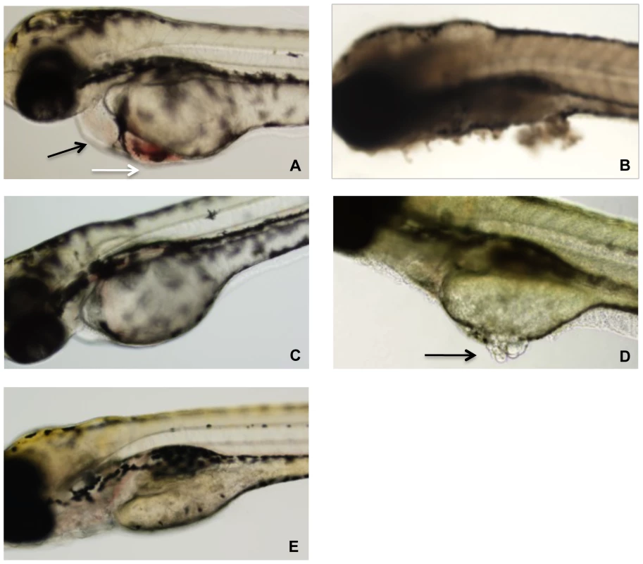 Representative photographs of zebrafish after 24 h exposure to TcdB.