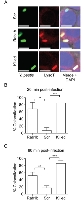 Rab1b knockdown alters YCV acidification.