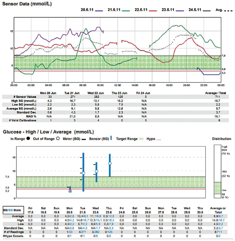 Muž (1953), DM 2. typu na inzulinu
Dne 21. 6. 2011 proveden aortofemorální bypass s profundoplastikou (10.30–14.30 hod) v celkové anestezii, téhož dne reoperován – provedena endarterektomie a trombektomie (14.30–16.30 hod) v subarachnoidální anestezii. Přes den podány tři infuze s glukózou: glukóza 10% 500 ml s 4 j. Humulin R od 6.00 do 9.00 hod, glukóza 10% 500 ml s 20 j. Humulin R od 15.30 do 17.30 hod, glukóza 10% 500 ml s 20 j. Humulin R od 19.30 do 21.30 hod.
