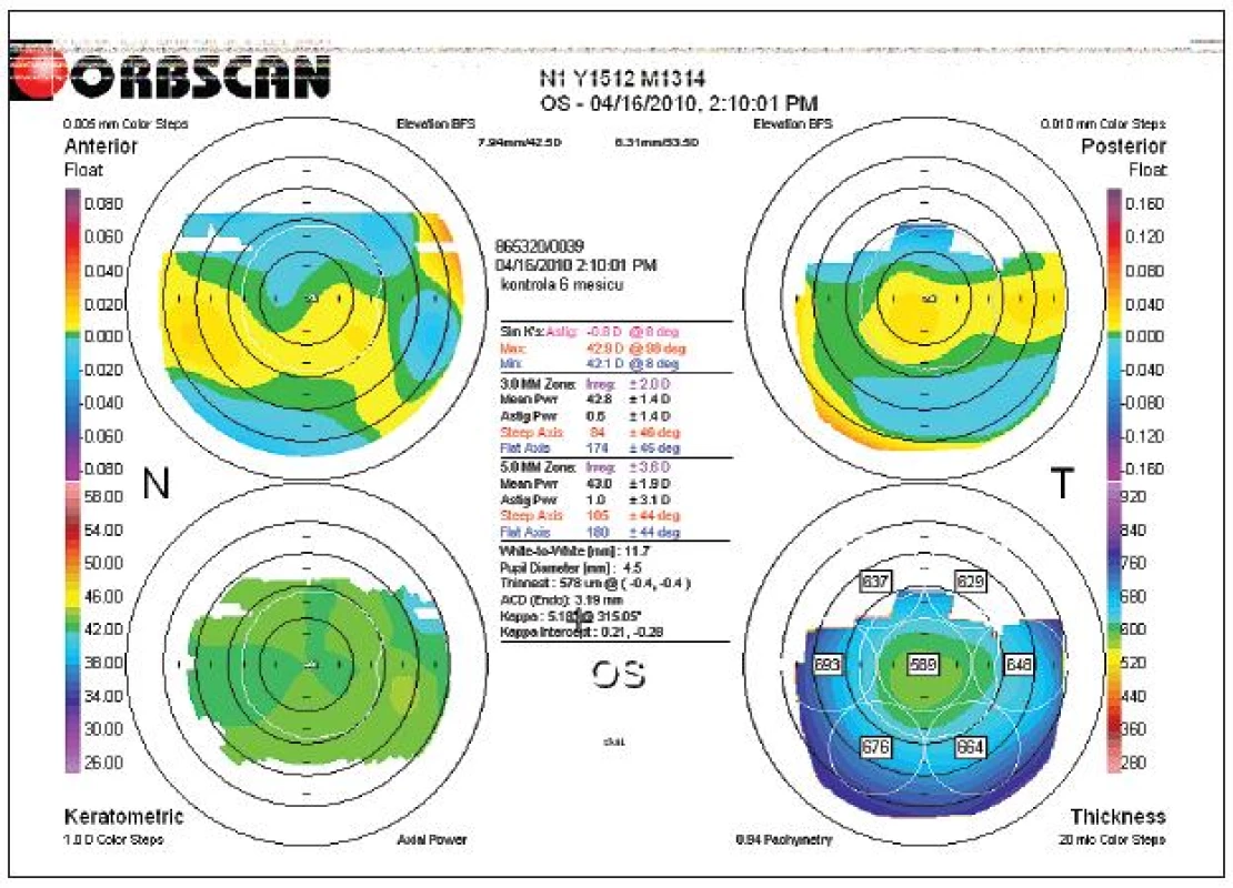 Pooperační topografické vyšetření oka levého