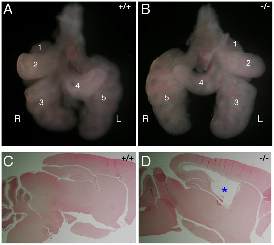 Abnormal left–right patterning and hydrocephalus in <i>Mns1</i>-deficient mice.
