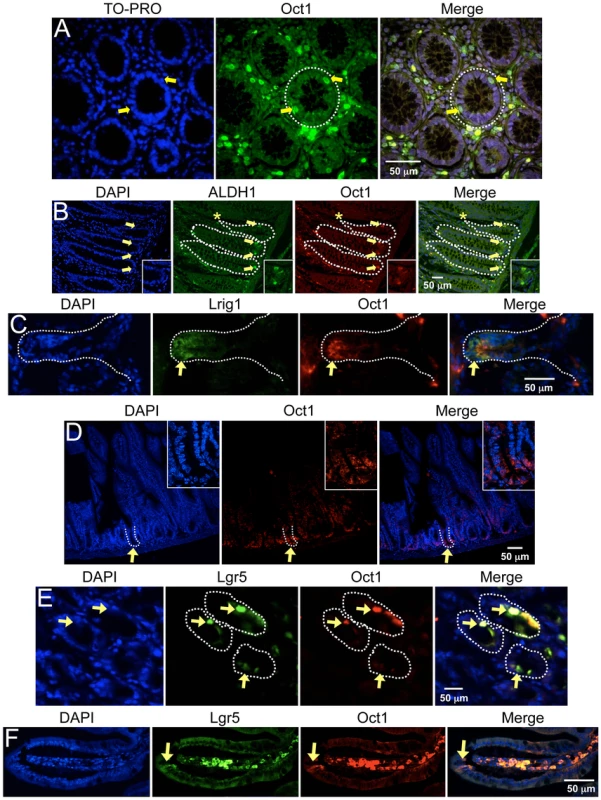 Association of Oct1 with normal somatic stem cells.