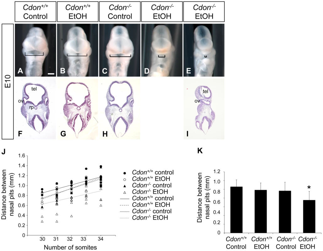 Synergy between loss of <i>Cdon</i> and fetal ethanol exposure produces HPE: E10.0.