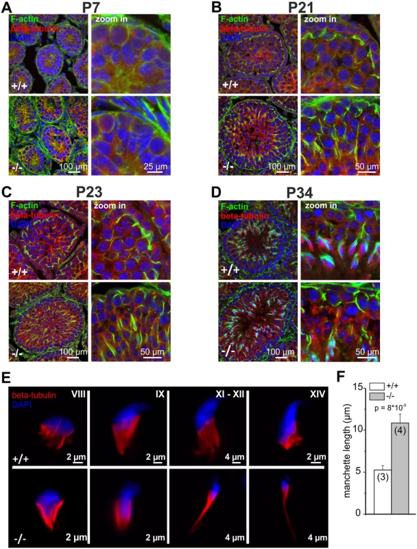 Cytoskeletal defects in GBA2 knockout-testis already occur during the first spermatogenic wave.