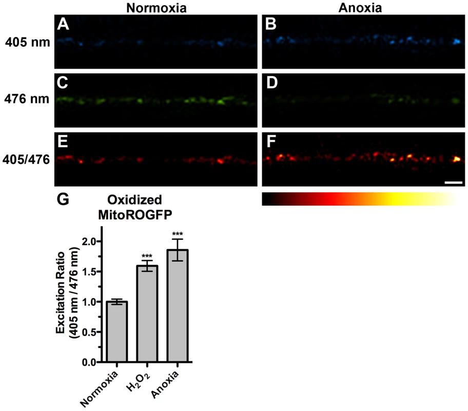 Anoxia induced mitochondrial oxidative stress.