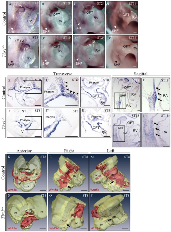 <i>Wnt5a</i> is expressed in the second heart field (SHF) and is downregulated in <i>Tbx1<sup>−/−</sup></i> embryos.